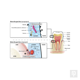 This diagram shows microbial details alongside the cross-section of a tooth